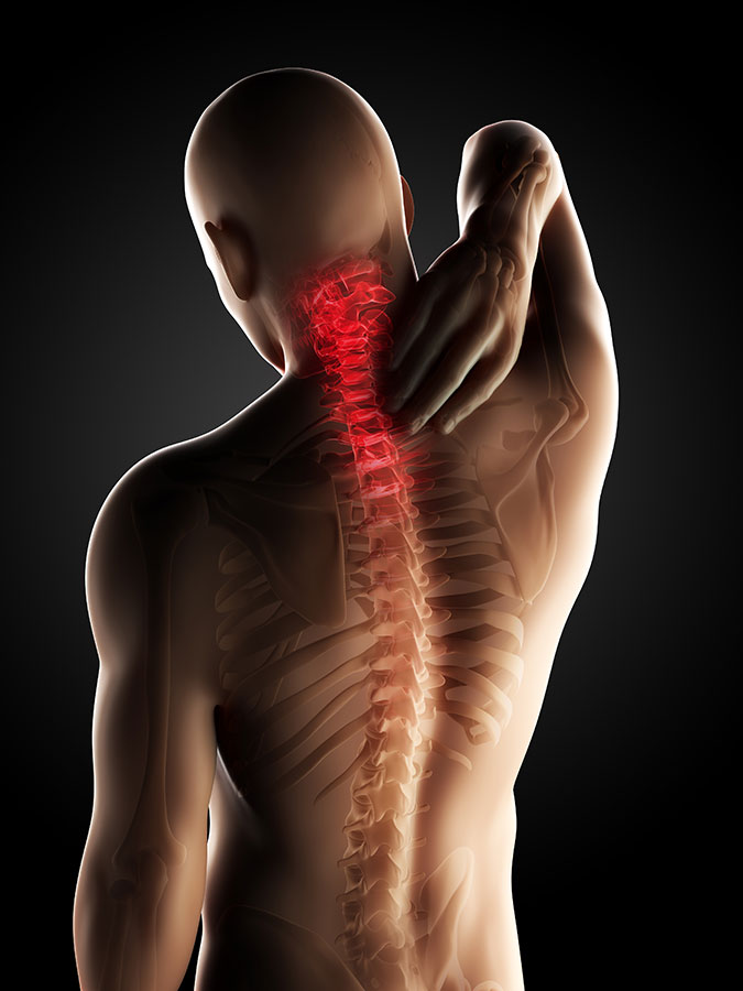 Neck Pain: Symptoms, Causes, Sudden neck pain? Our neck pain Physio in