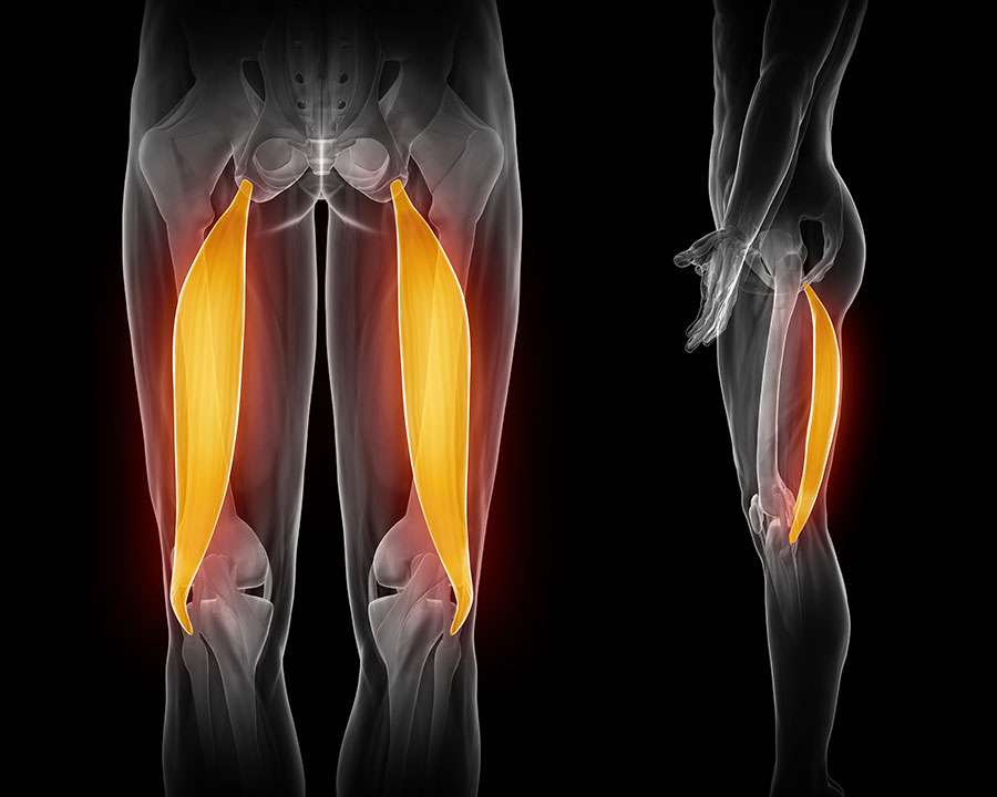 Hamstring tear, Hamstring strain: Torn Hamstring Muscle - Physio Pretoria