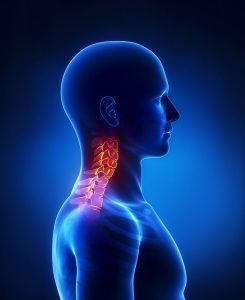 Correct cervical position Neck neutral spine_blue Neck Pain, Stiff Neck Muscles
