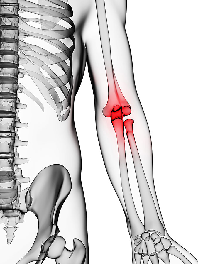 Joint Pain elbow pain