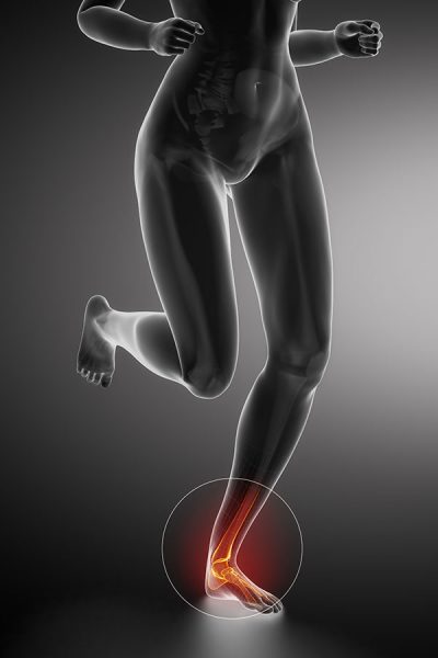 Foot pain, Foot injuries: Foot muscle pain: Physiotherapist Pretoria