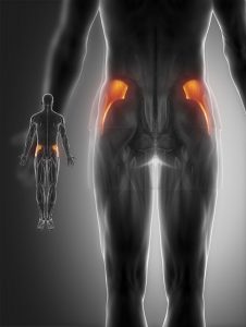 Gluteus muscle strain,