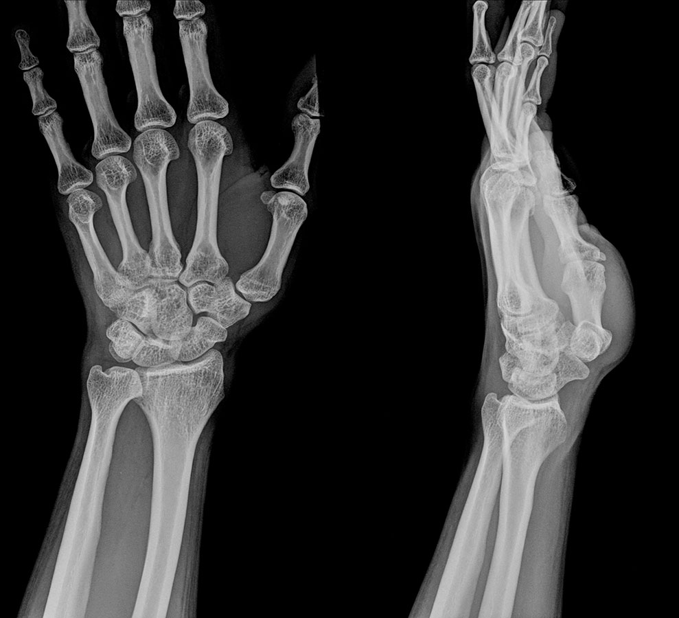 hand pain, hand injuries, hand injury, hand pain treatment, hand pain therapist