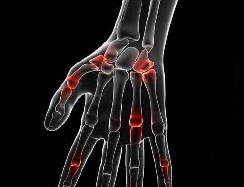 Nerve pain in Hand: Causes & Symptoms of Nerve pain - Hand therapist