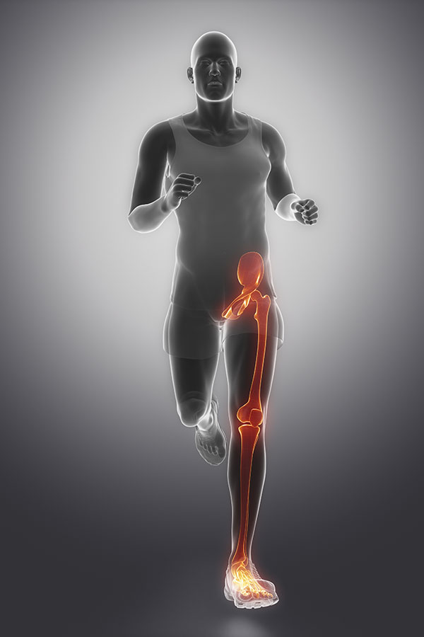 Hip Pain, Hip Injury Gait analysis