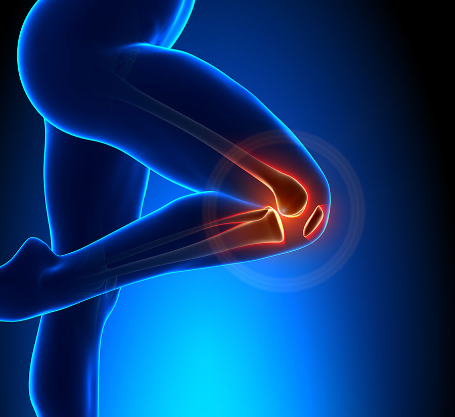 Knee Joint Osteoarthritis