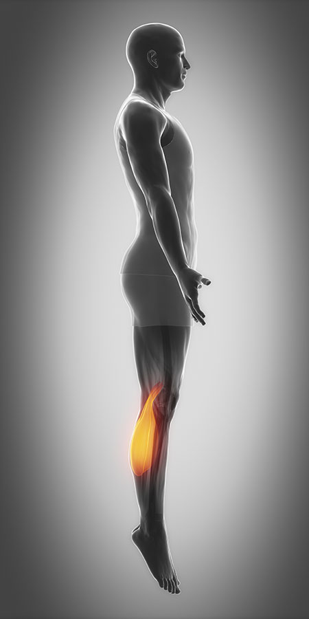 Lateral and Medial Head of the Gastrocnemius (Calf) Muscle_side Calf muscle tear