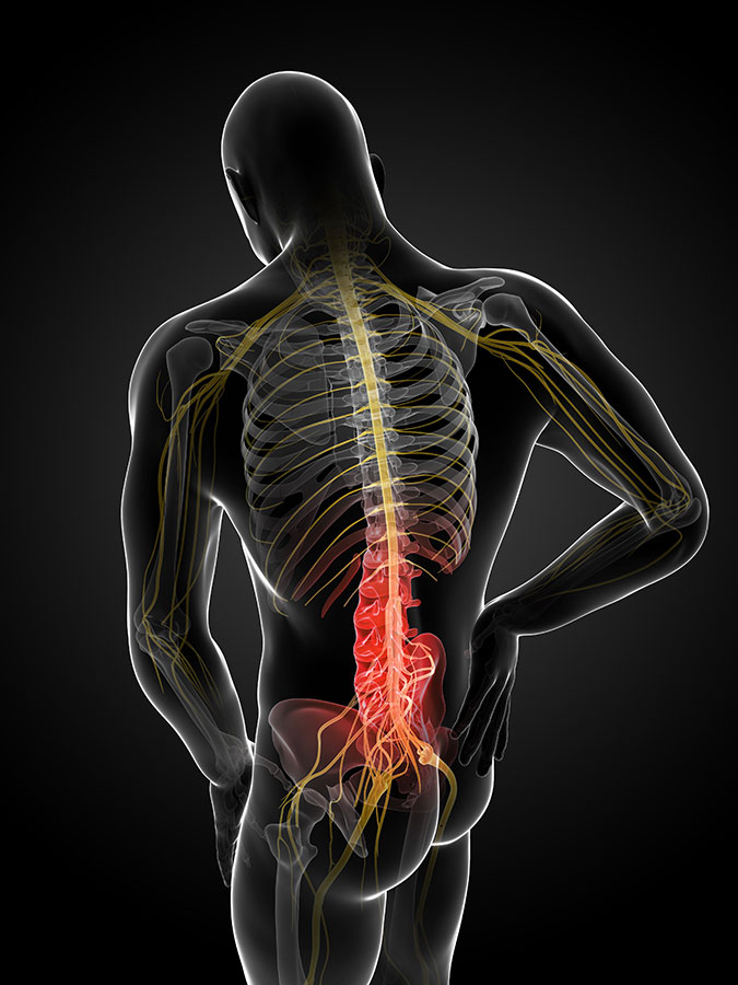 Lumbar Nerve Pain Chart