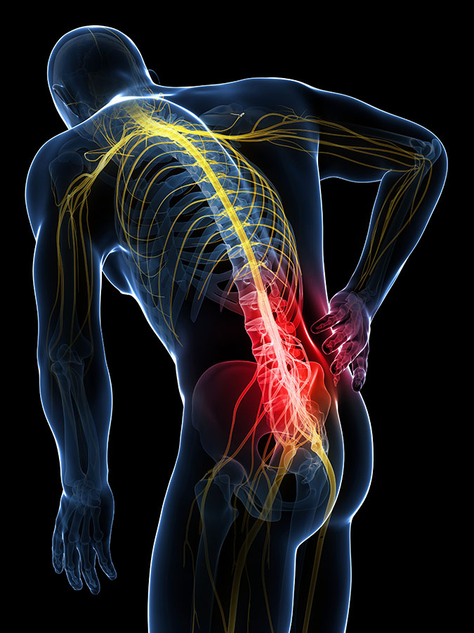 What is sciatica and how to deal with common causes of leg pain? - by MD  Thordis Berger