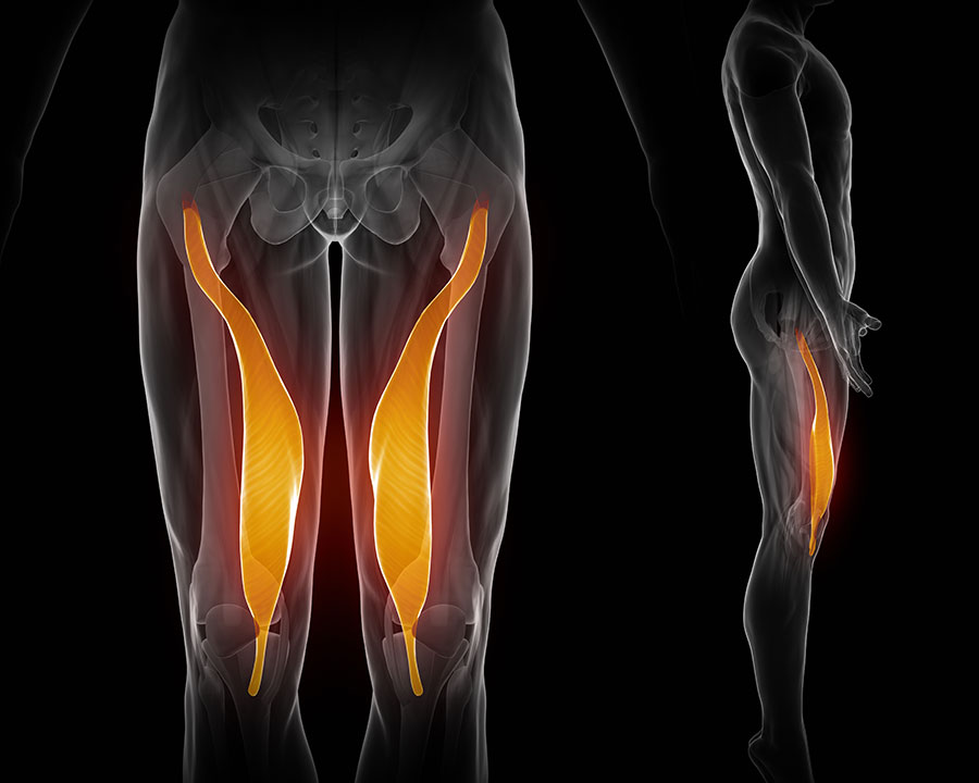 Quadriceps muscle strain or tear: Torn Quad muscle, Physio Pretoria