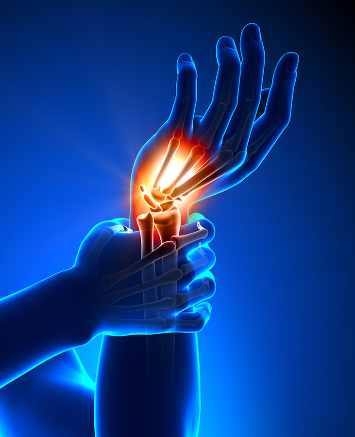 hand nerve pain