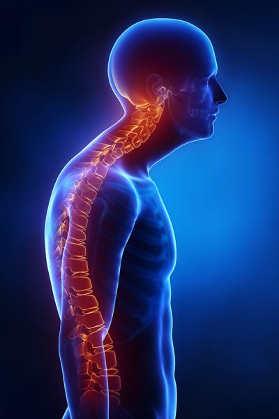 Cervical spondylosis means Neck Joint Degeneration: Stiff neck joints