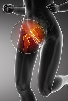 Groin pain, Nerve pain in groin, Groin muscle pain, Groin pain treatment, Pain in groin