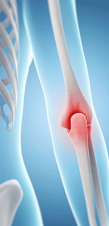 Joint Pain Arm Joint pain, Joint inflammation, Joint dislocation, Joint treatment
