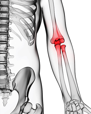 Joint Pain Treatment Joint pain, Joint inflammation, Joint dislocation, Joint treatment