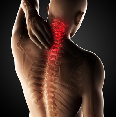 Neck pain Treatment: Our Physios Test & Treat Severe neck pain