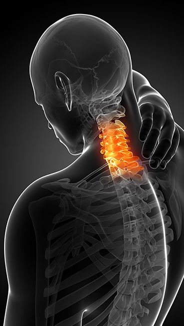 neck pain, Sudden neck pain, Sharp neck pain, Severe neck pain, Pain in neck