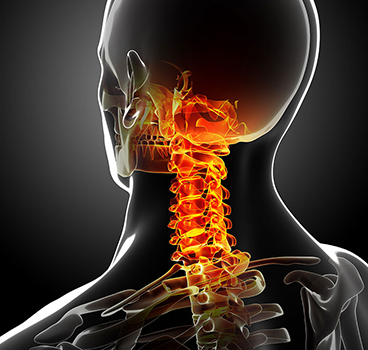 neck pain, Sudden neck pain, Sharp neck pain, Severe neck pain, Pain in neck