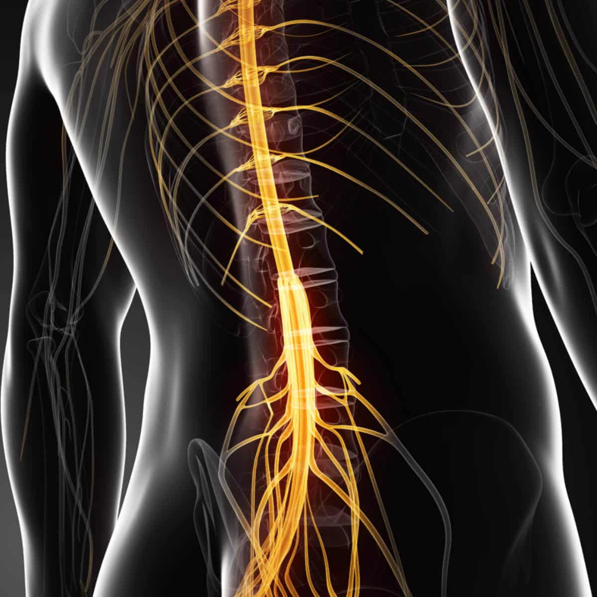 Pinched Nerve, Nerve compression: Symptoms Treatment