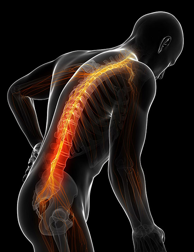 Sciatic nerve pain, Pinched sciatic nerve, Sciatic nerve injury, Sciatic nerve compression, Sciatic nerve irritation
