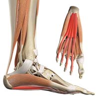 Plantar Fasciitis treatment: Pain form the Plantar Fascia, foot & heel ...