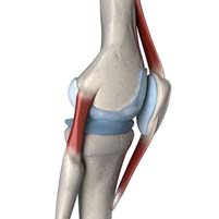Knee Ligament Injuries (tear & sprained) - Knee ligament sprain: Physio