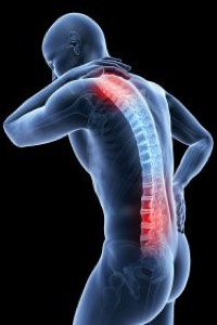 Scoliosis in upper or lower back pain