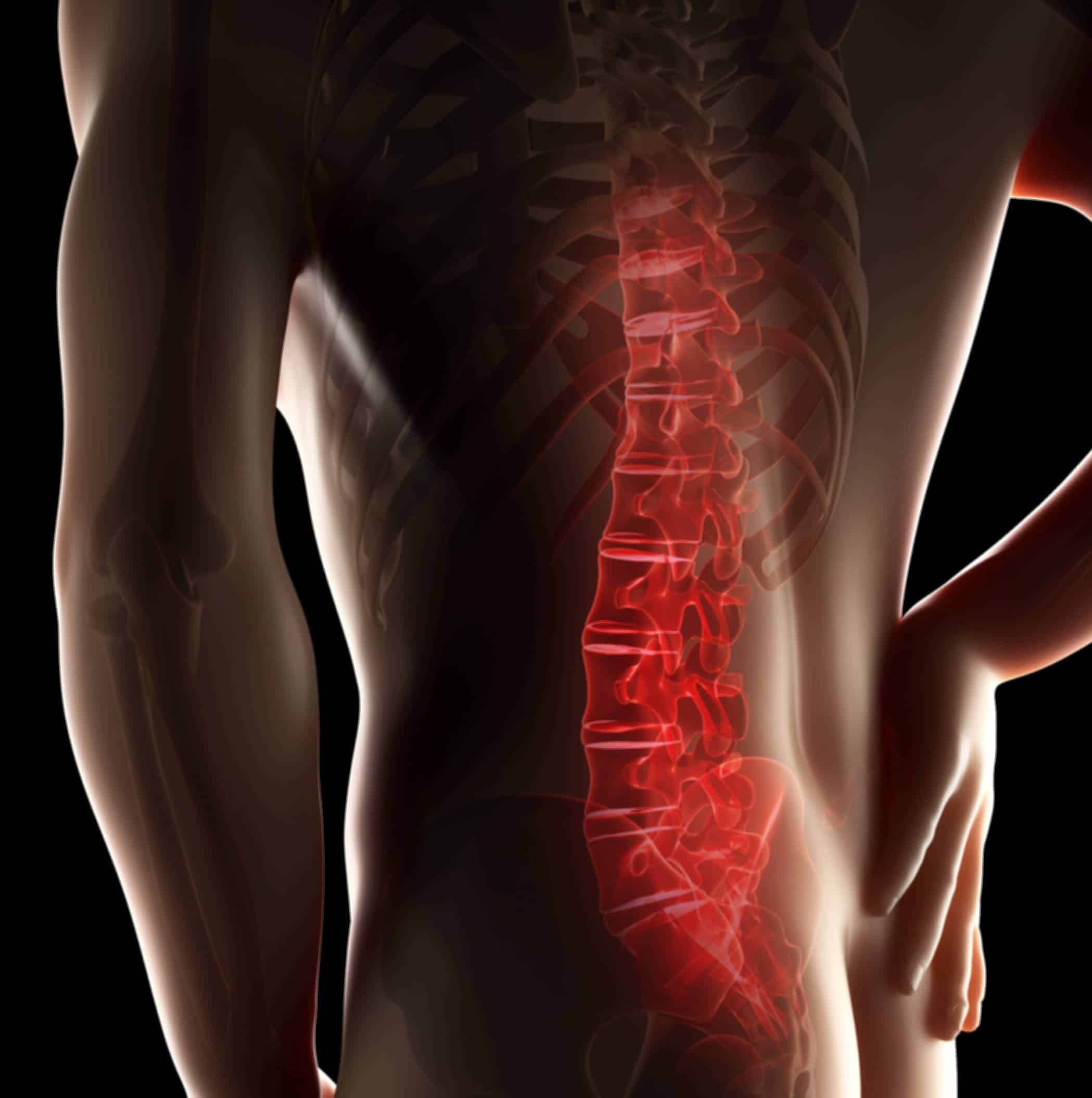 Living with Lower Back Pain