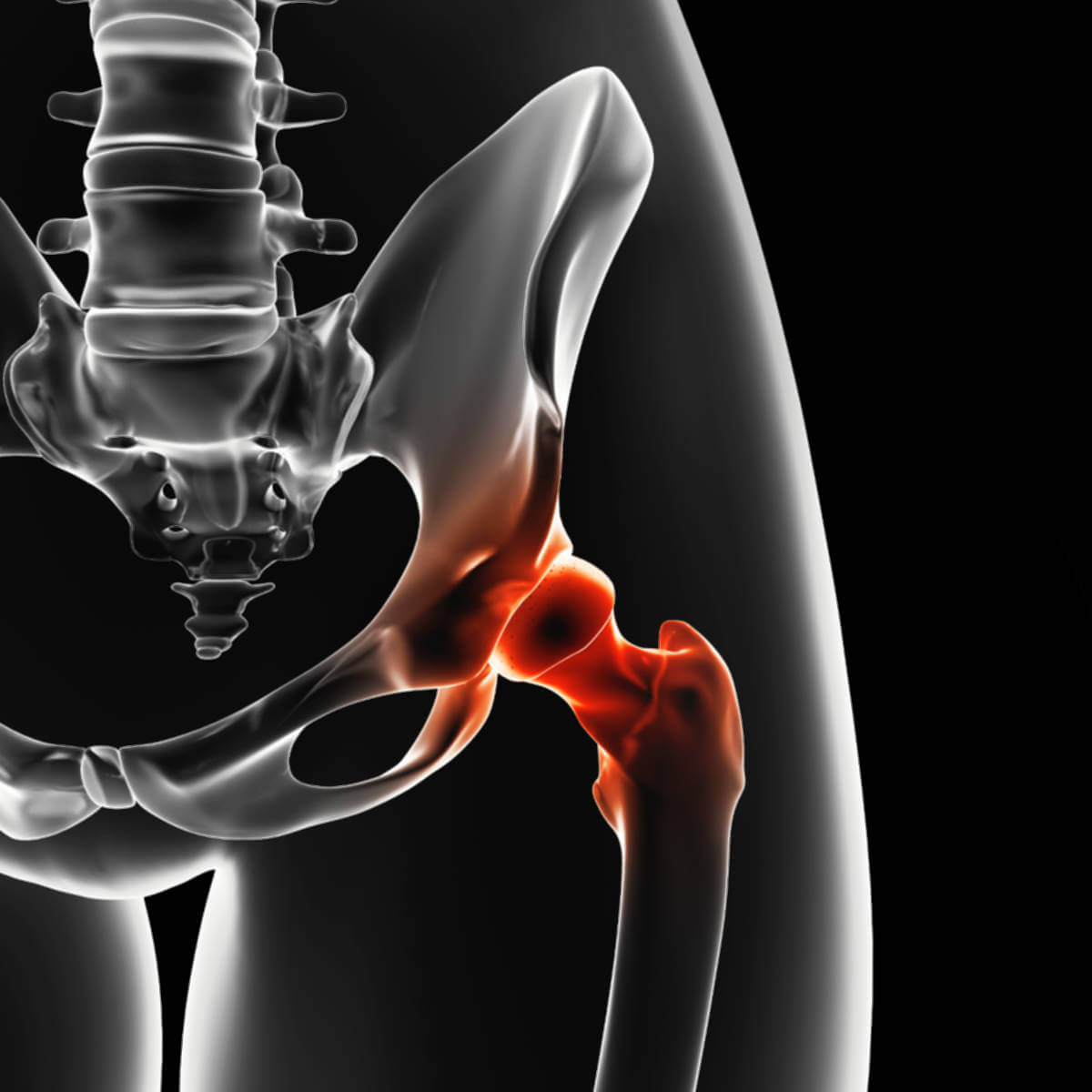 Hip Pain Causes, Conditions and Treatments