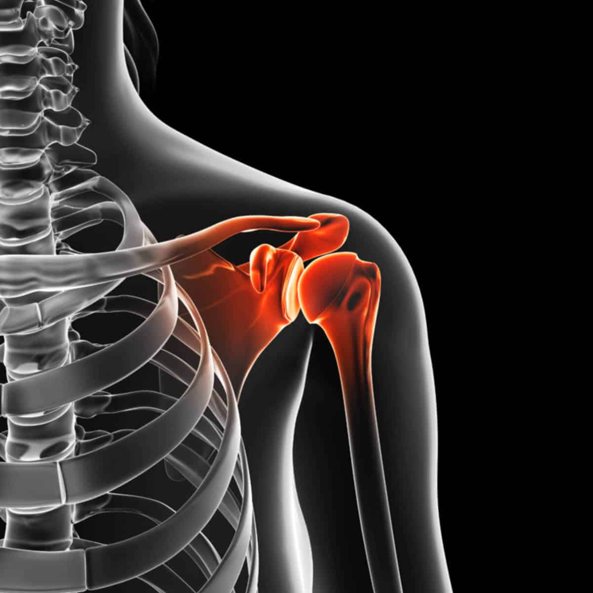 Shoulder Conditions We diagnose & treat - Physios @WHP